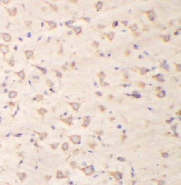 anti- GRIN1 antibody