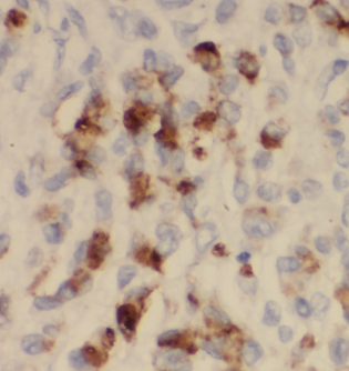 anti- CTSE antibody