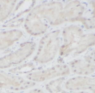 anti- HNF1B antibody