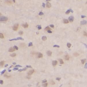 anti- HBS1L antibody