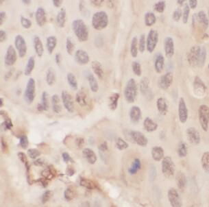 anti- Cytokeratin 1 antibody