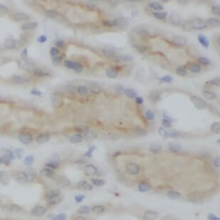 anti- LGP2 antibody