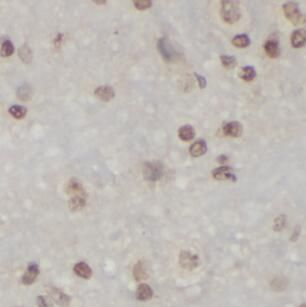 anti- HMGB1 antibody