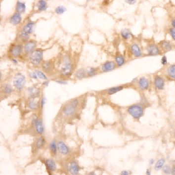 anti- PRDX4 antibody