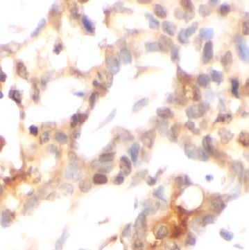 anti- ICT1 antibody