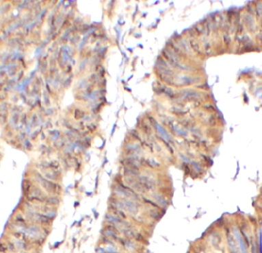   TRPV1 / anti- TRPV1 antibody
