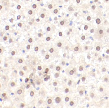 anti- LPP antibody