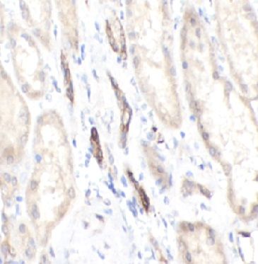 anti- MICB antibody