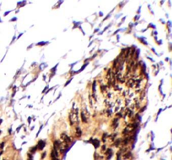 anti- WBSCR16 antibody