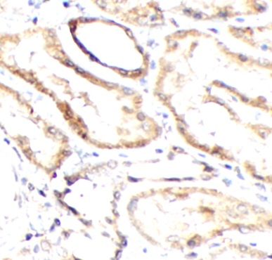 anti- CHGA antibody