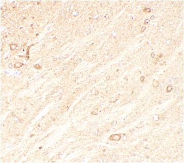 anti- CADM1 antibody