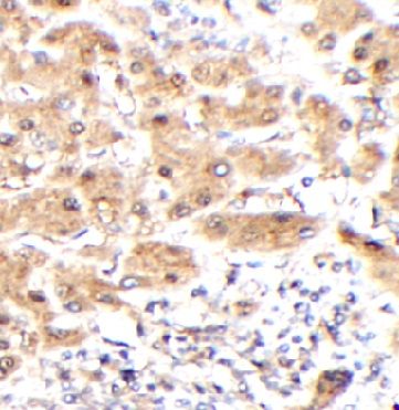 anti- IRF5 antibody