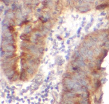 anti- EIF2C1 antibody