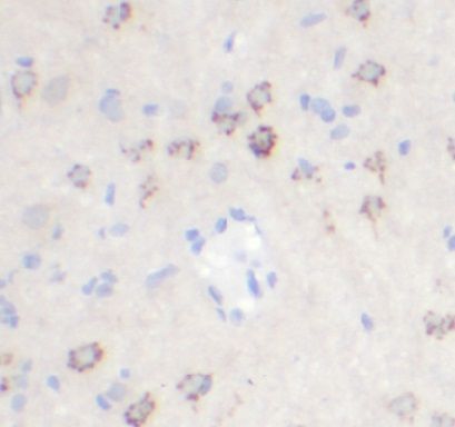 anti- CEP350 antibody