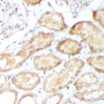 anti- GADD34 antibody