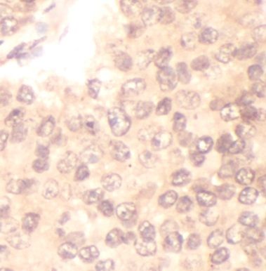 anti- ADRA2B antibody