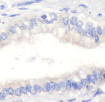 anti- CFHR3 antibody