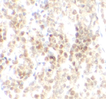 anti- DNMT1 antibody