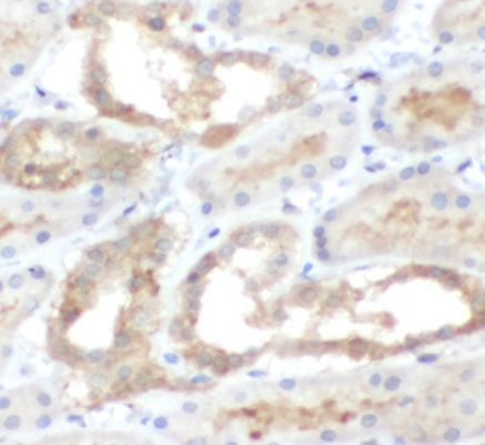 anti- PADI2 antibody