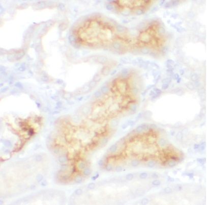 anti- ITFG1 antibody
