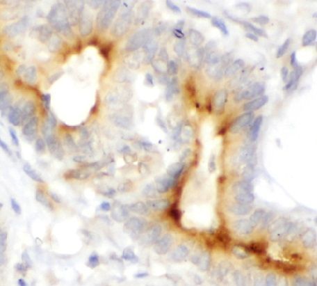 anti- HSP47 antibody