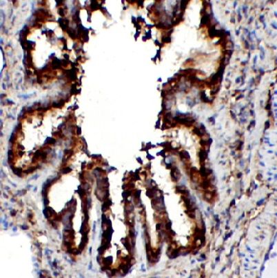 anti- NME1 antibody