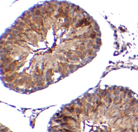 anti- TMEM41B antibody