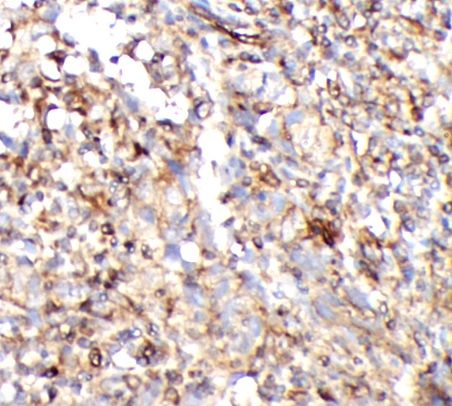 CD8+ (anti- CD8 monoclonal antibody)