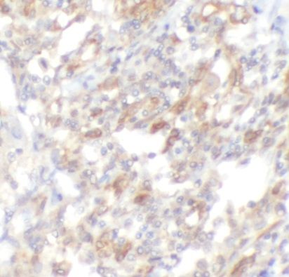 anti- CD4 monoclonal antibody