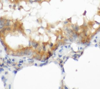 anti- CGAS antibody