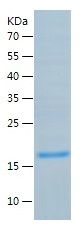    Asprosin / Recombinant Human Asprosin