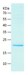    β-Actin / Recombinant Human β-Actin