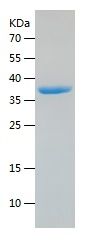    GAPDH / Recombinant Human GAPDH