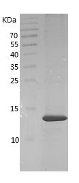    FABP4 / Recombinant Human FABP4