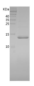    FABP5 / Recombinant Human FABP5