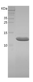    FABP6 / Recombinant Human FABP6