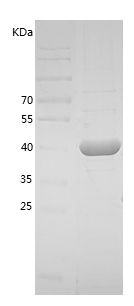    PAI-1 / Recombinant Human PAI-1