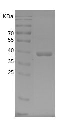 Recombinant Rat PAI-1