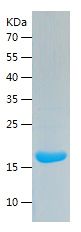    IL-1b / Recombinant Human IL-1b