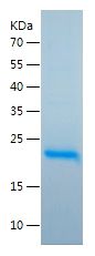    IL-6 / Recombinant Human IL-6