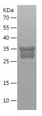    HMGB1 / Recombinant Human HMGB1