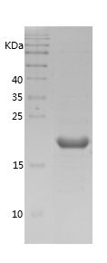    Cofilin / Recombinant Human Cofilin