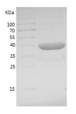    ubc13 / Recombinant Human ubc13