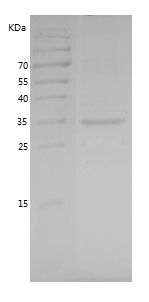    TRAM1 / Recombinant Human TRAM1