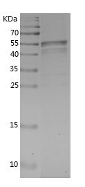    IRAK4 / Recombinant Human IRAK4