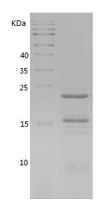    RIP1 / Recombinant Human RIP1