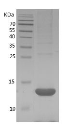    SAA / Recombinant Human SAA