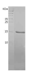    FABP3 / Recombinant Human FABP3