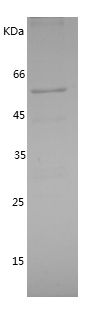    IRAK2 / Recombinant Human IRAK2