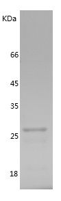    TAB1 / Recombinant Human TAB1